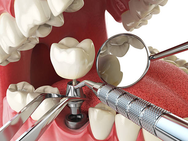 Best Emergency Tooth Extraction in Portage, PA